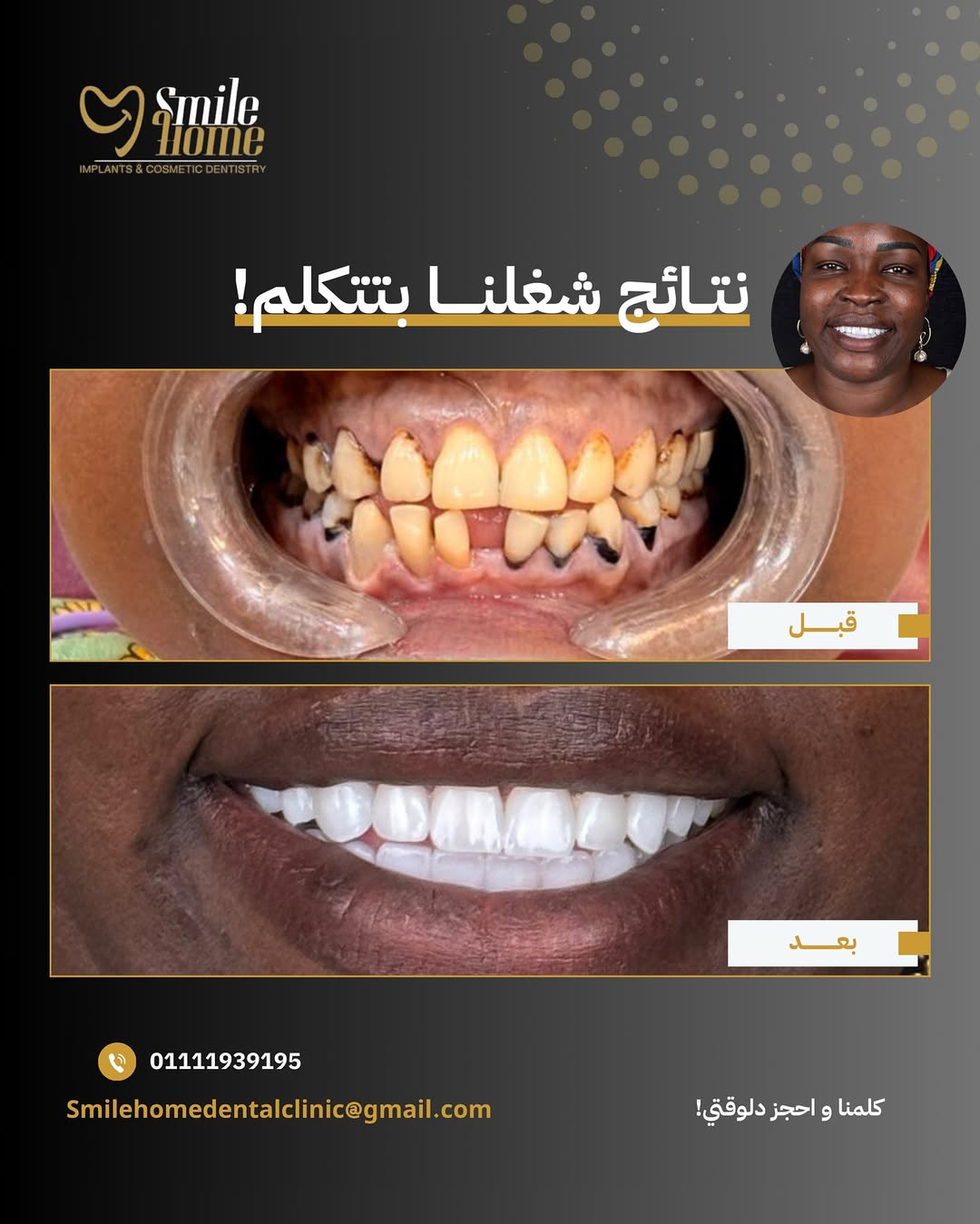 Dental Package